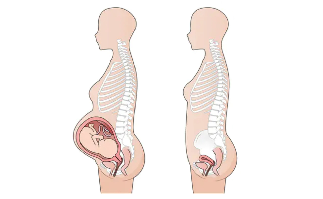 妊娠時の骨盤にかかるストレスを表した図