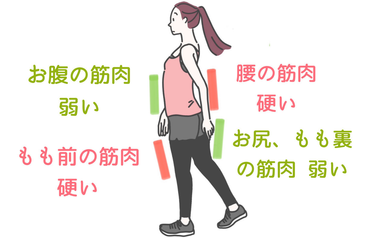 産後の筋バランスの崩れ