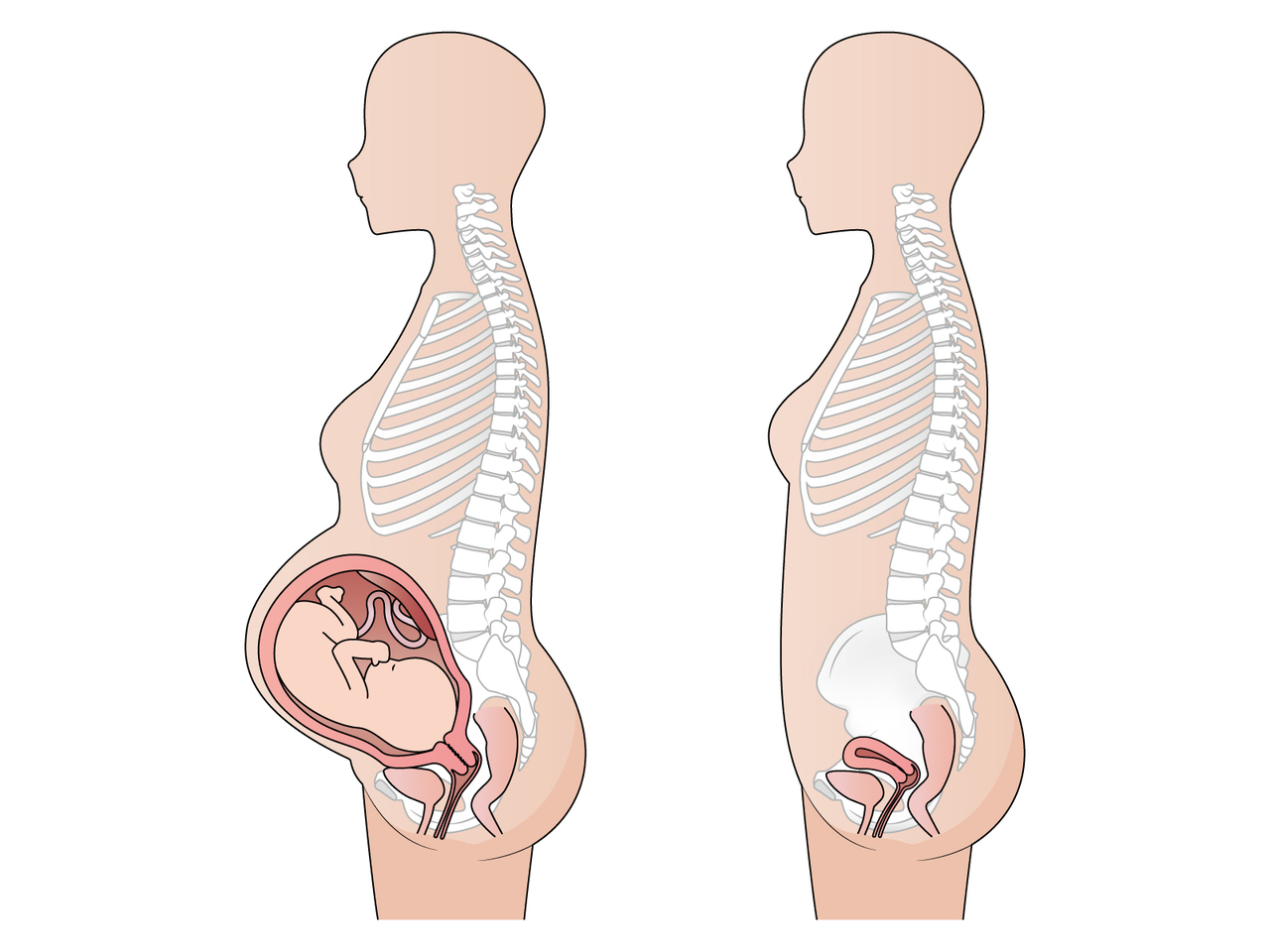 妊娠時の骨盤にかかるストレスを表した図